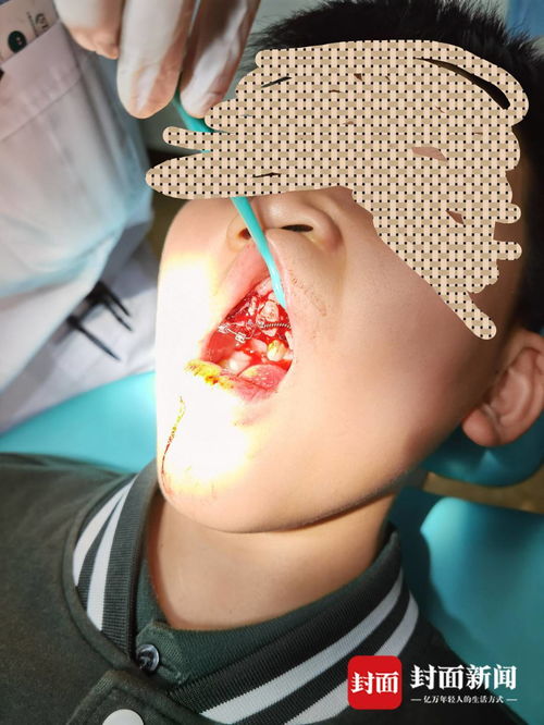 重慶特斯拉車(chē)主遭遇驚魂一幕 停車(chē)時(shí)車(chē)輛自動(dòng)加速撞墻，致孩子受傷